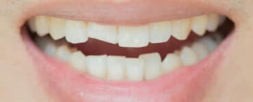 mutuelle dents